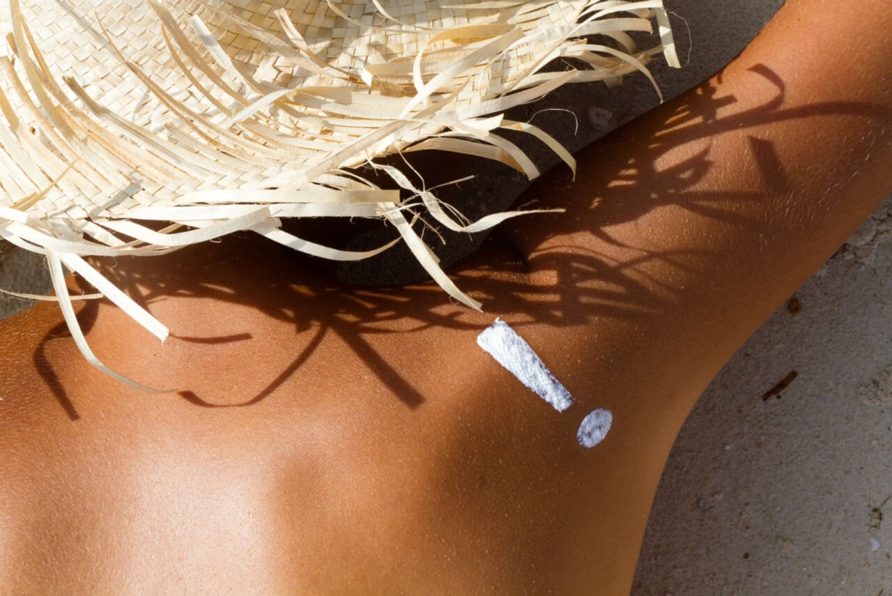 10-surprising-things-that-make-a-sunburn-worse-and-what-you-should-do